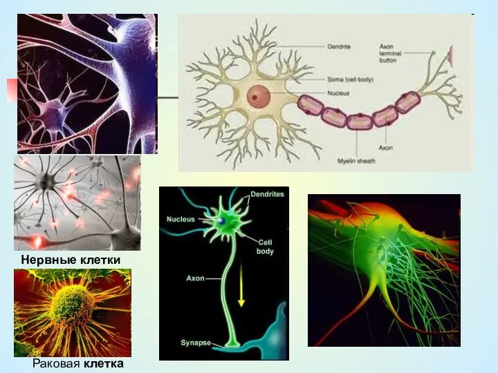 Нервные клетки Раковая клетка