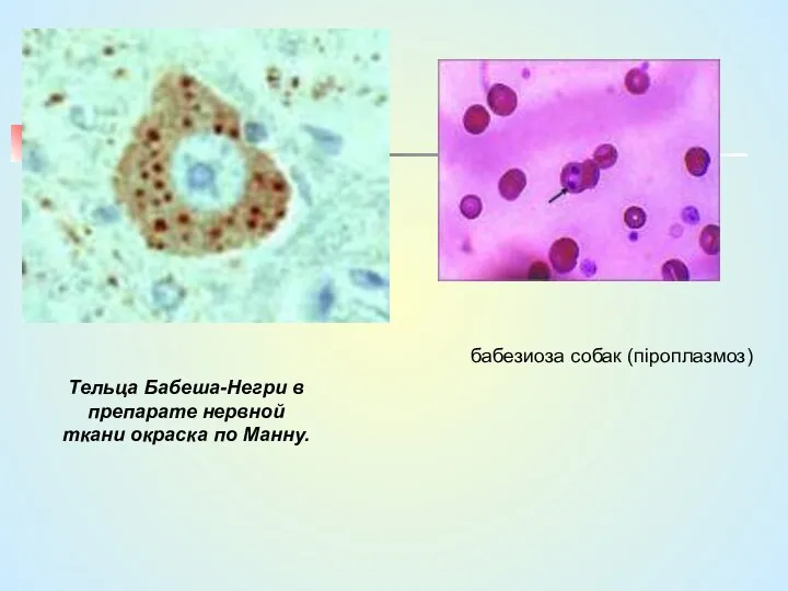 Тельца Бабеша-Негри в препарате нервной ткани окраска по Манну. бабезиоза собак (піроплазмоз)