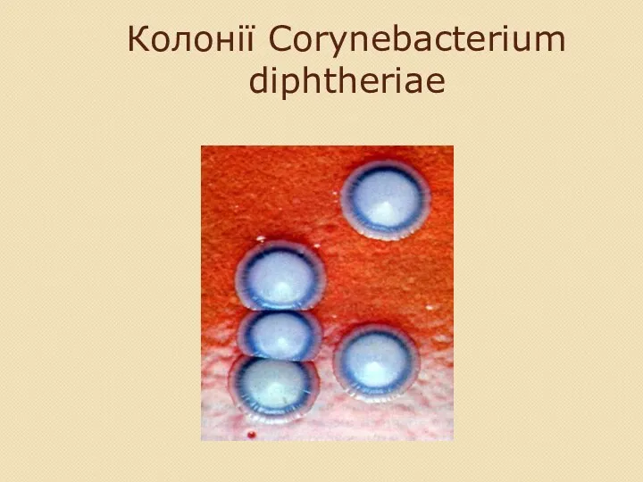 Колонії Corynebacterium diphtheriae