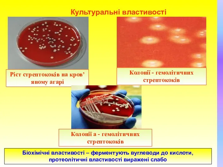 Колонії - гемолітичних стрептококів Колонії a - гемолітичних стрептококів Ріст стрептококів на кров’яному