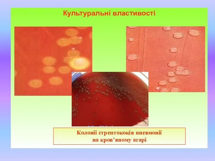 Культуральні властивості Колонії стрептококів пневмонії на кров’яному агарі