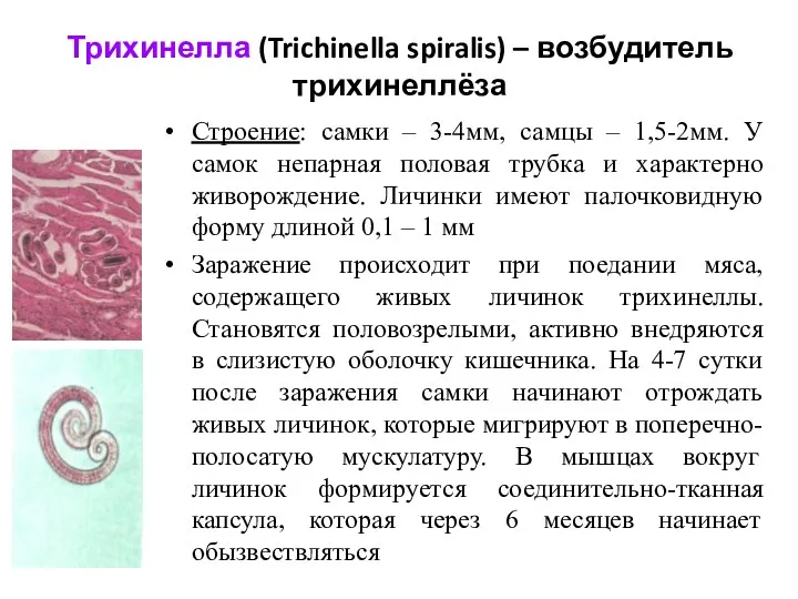 Трихинелла (Trichinella spiralis) – возбудитель трихинеллёза Строение: самки – 3-4мм,