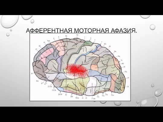 АФФЕРЕНТНАЯ МОТОРНАЯ АФАЗИЯ.