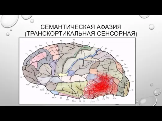 СЕМАНТИЧЕСКАЯ АФАЗИЯ (ТРАНСКОРТИКАЛЬНАЯ СЕНСОРНАЯ)