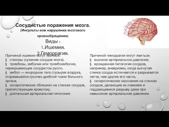 Сосудистые поражения мозга. (Инсульты или нарушения мозгового кровообращения) Виды :