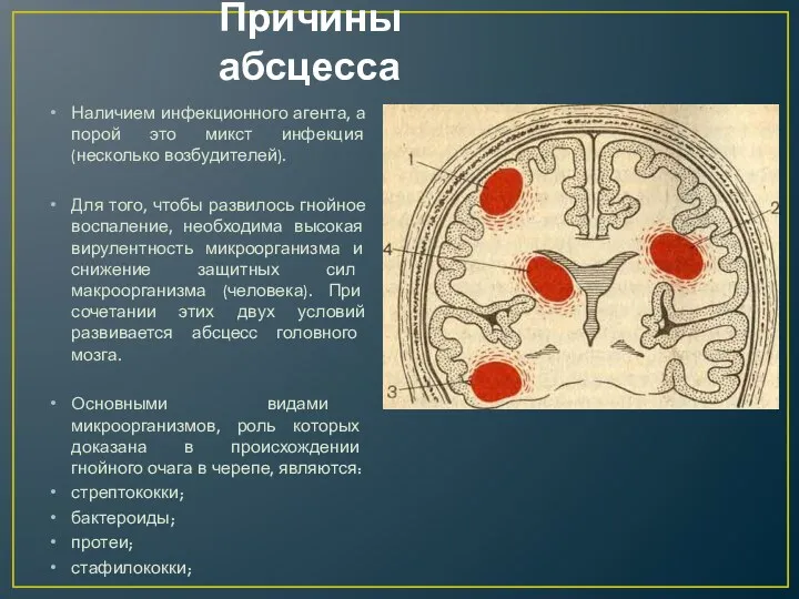 Причины абсцесса Наличием инфекционного агента, а порой это микст инфекция