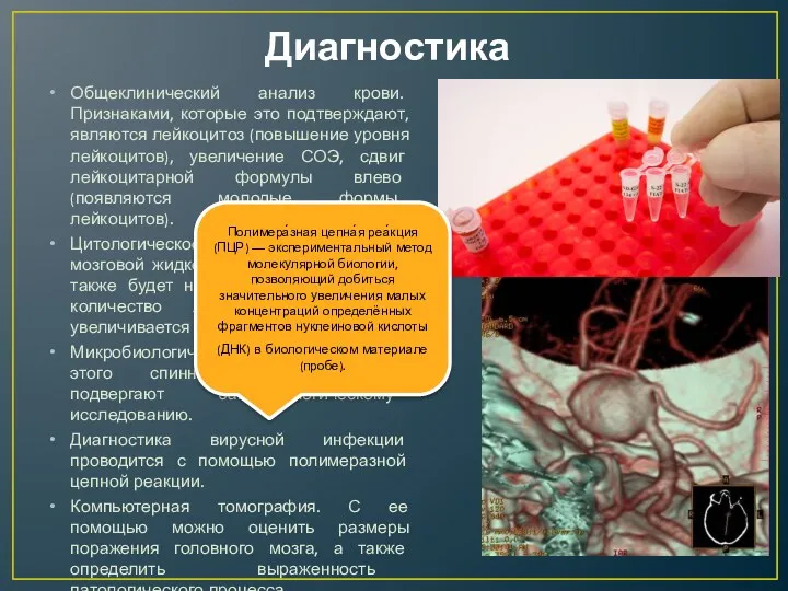 Диагностика Общеклинический анализ крови. Признаками, которые это подтверждают, являются лейкоцитоз