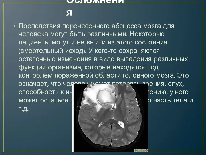 Осложнения Последствия перенесенного абсцесса мозга для человека могут быть различными.