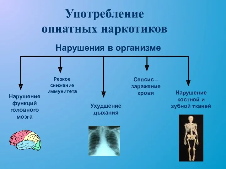 Употребление опиатных наркотиков Нарушение функций головного мозга Нарушение костной и