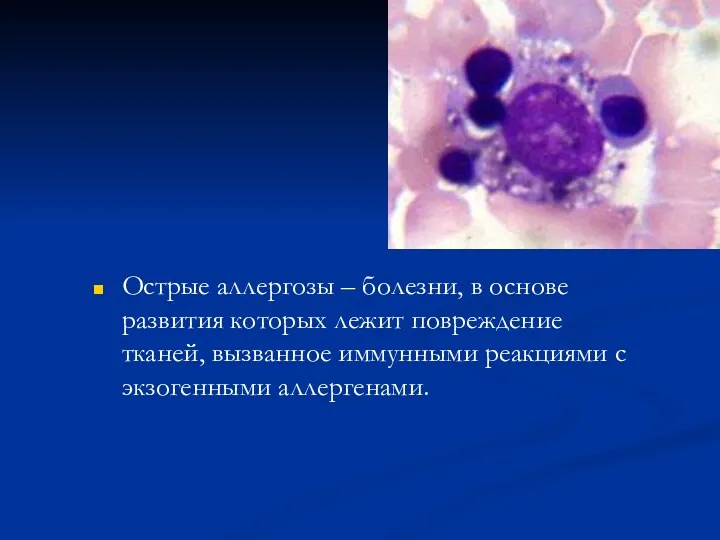 Острые аллергозы – болезни, в основе развития которых лежит повреждение