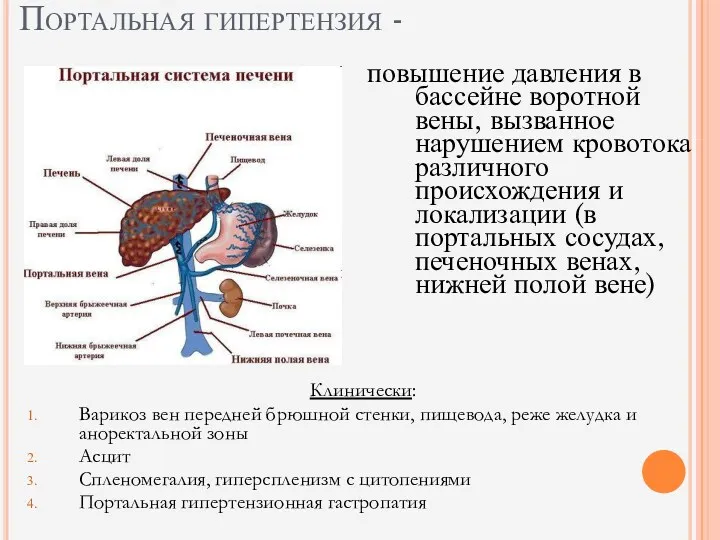 Портальная гипертензия - повышение давления в бассейне воротной вены, вызванное