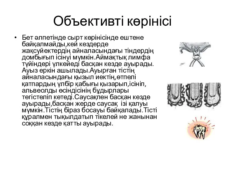 Объективті көрінісі Бет әлпетінде сырт көрінісінде ештене байқалмайды,кей кездерде жақсүйектердің