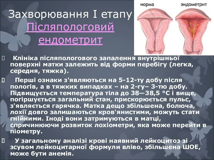 Захворювання I етапу Післяпологовий ендометрит Клініка післяпологового запалення внутрішньої поверхні