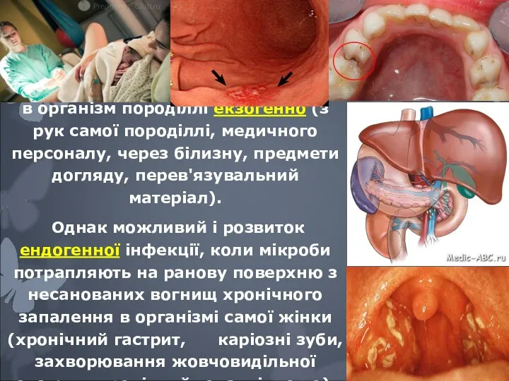 Інфекційний агент може проникати в організм породіллі екзогенно (з рук