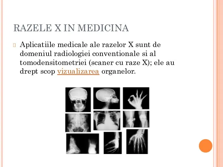RAZELE X IN MEDICINA Aplicatiile medicale ale razelor X sunt de domeniul radiologiei