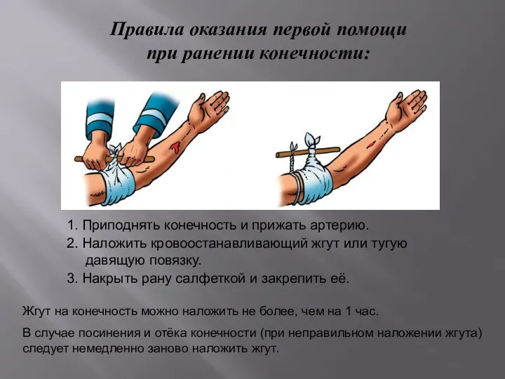 Правила оказания первой помощи при ранении конечности: 1. Приподнять конечность и прижать артерию.