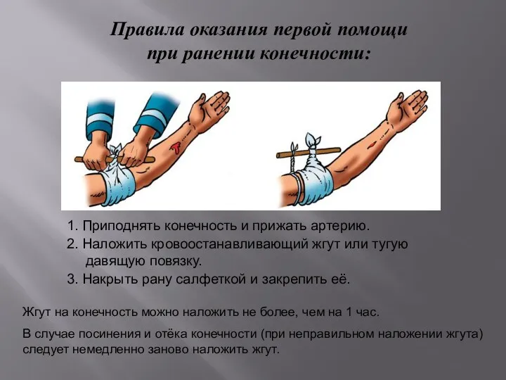 Правила оказания первой помощи при ранении конечности: 1. Приподнять конечность