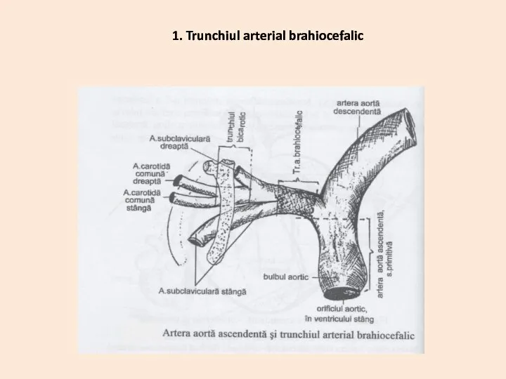 1. Trunchiul arterial brahiocefalic