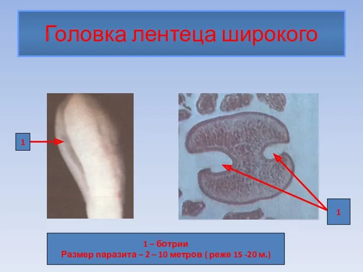 Головка лентеца широкого 1 1 1 – ботрии Размер паразита