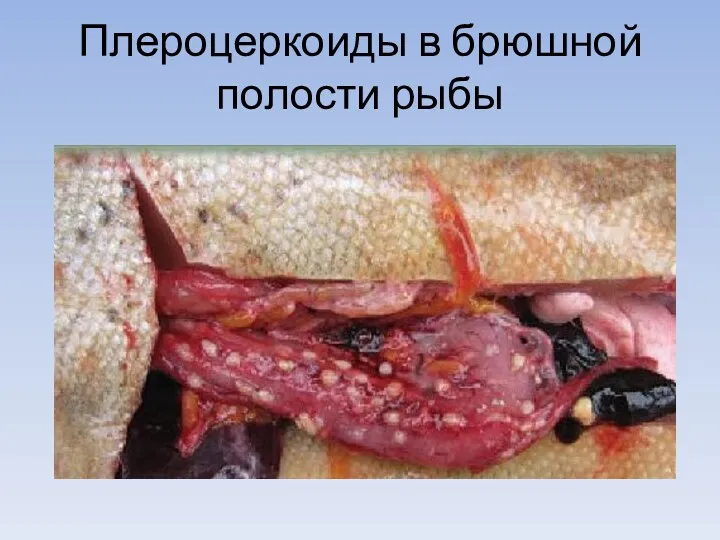 Плероцеркоиды в брюшной полости рыбы