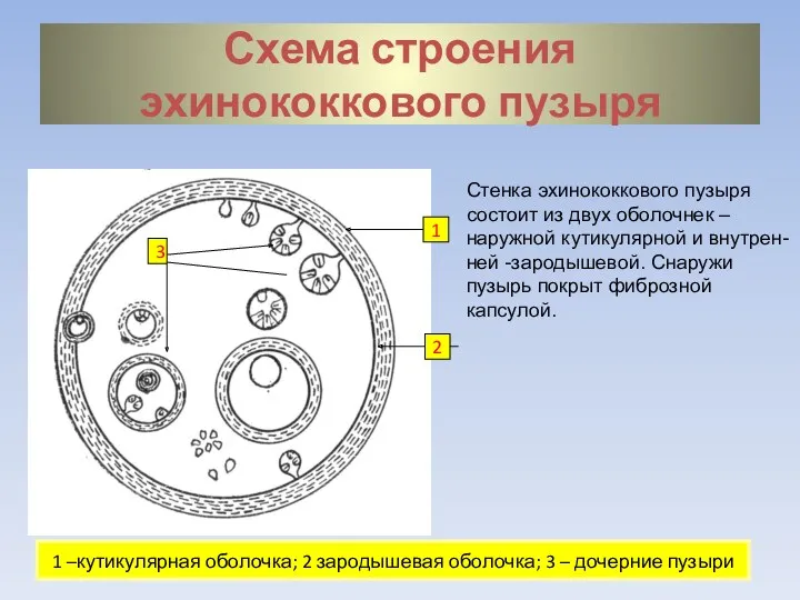 Схема строения эхинококкового пузыря 1 2 3 1 –кутикулярная оболочка; 2 зародышевая оболочка;