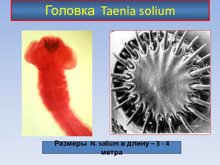 Головка Taenia solium Размеры N. solium в длину – 3 - 4 метра