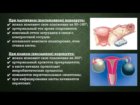 При частичном (постепенном) перекруте: ножка изменяет свое положение на 90–180°;