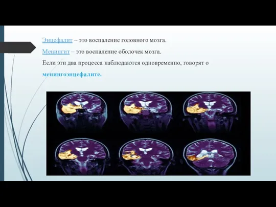 Энцефалит – это воспаление головного мозга. Менингит – это воспаление оболочек мозга. Если