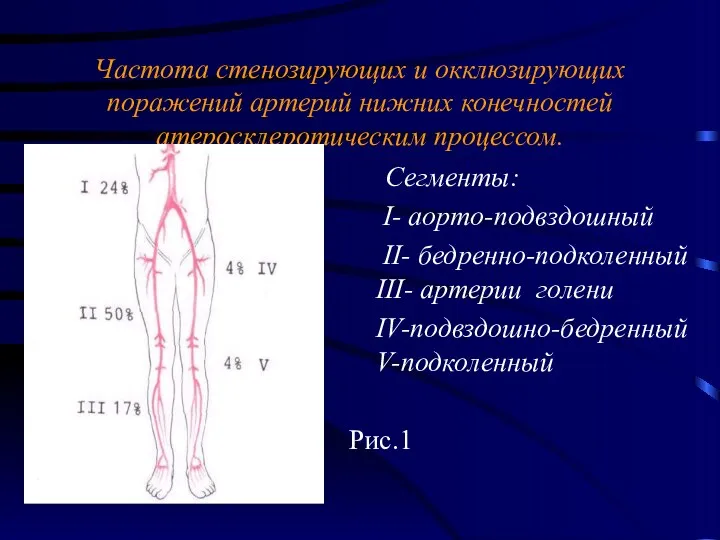 Частота стенозирующих и окклюзирующих поражений артерий нижних конечностей атеросклеротическим процессом.