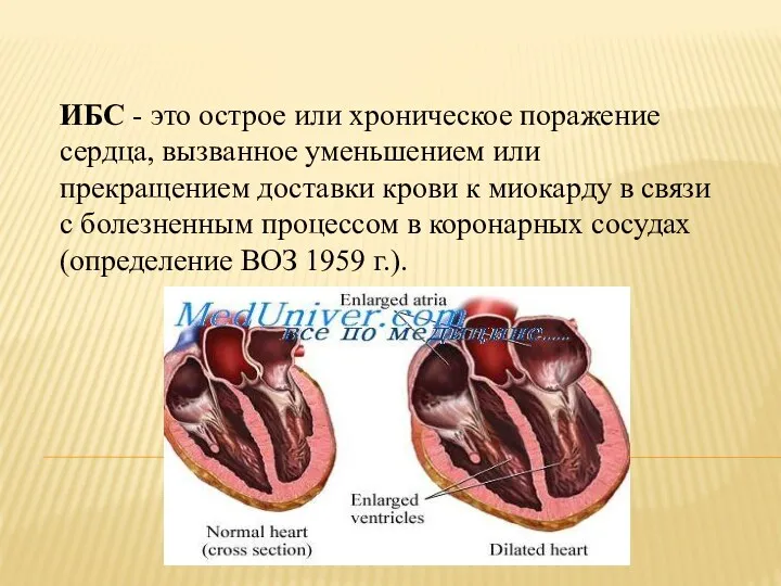 ИБС - это острое или хроническое поражение сердца, вызванное уменьшением