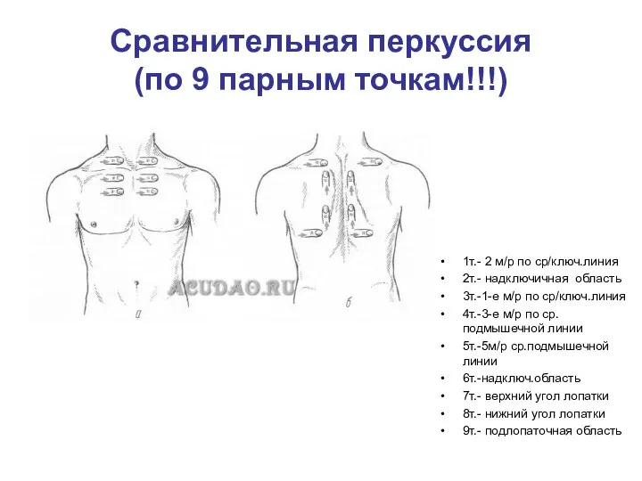 Сравнительная перкуссия (по 9 парным точкам!!!) 1т.- 2 м/р по