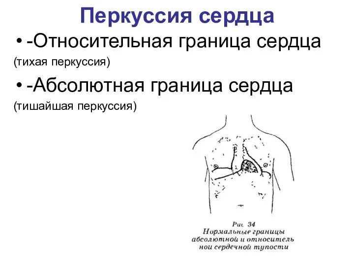 Перкуссия сердца -Относительная граница сердца (тихая перкуссия) -Абсолютная граница сердца (тишайшая перкуссия)