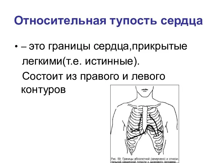 Относительная тупость сердца – это границы сердца,прикрытые легкими(т.е. истинные). Состоит из правого и левого контуров