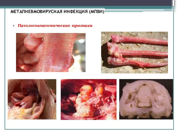 МЕТАПНЕВМОВИРУСНАЯ ИНФЕКЦИЯ (МПВИ) Патологоанатомические признаки