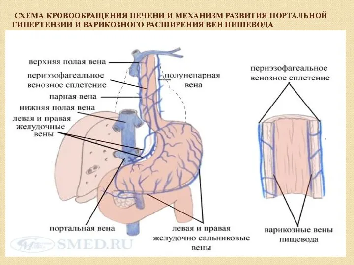 СХЕМА КРОВООБРАЩЕНИЯ ПЕЧЕНИ И МЕХАНИЗМ РАЗВИТИЯ ПОРТАЛЬНОЙ ГИПЕРТЕНЗИИ И ВАРИКОЗНОГО РАСШИРЕНИЯ ВЕН ПИЩЕВОДА