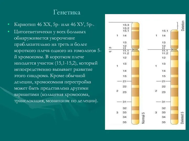 Генетика Кариотип 46 XX, 5p- или 46 ХУ, 5р-. Цитогенетически