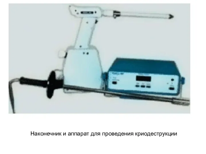 Наконечник и аппарат для проведения криодеструкции