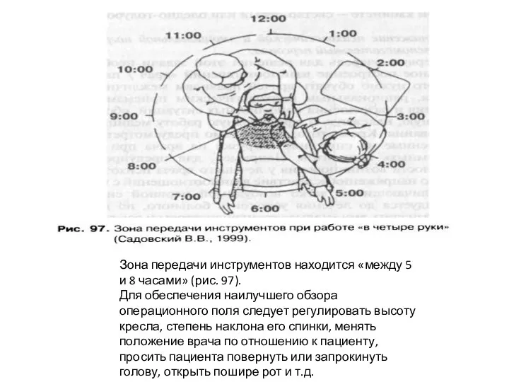 Зона передачи инструментов находится «между 5 и 8 часами» (рис.