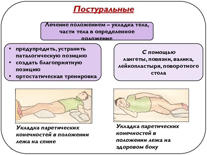 Постуральные Лечение положением – укладка тела, части тела в определенное