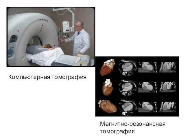 Компьютерная томография Магнитно-резонансная томография