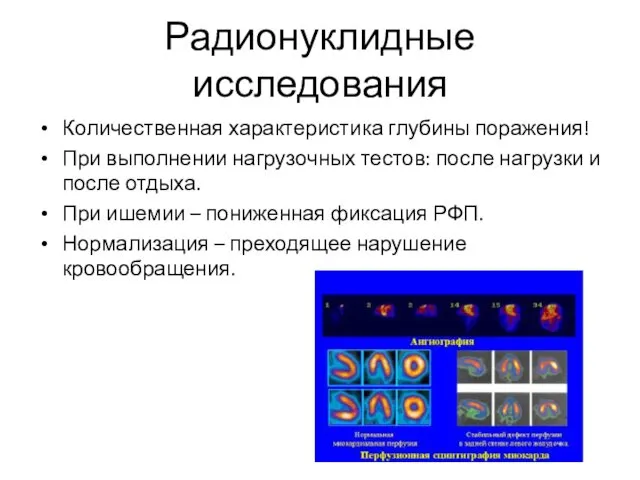 Радионуклидные исследования Количественная характеристика глубины поражения! При выполнении нагрузочных тестов: после нагрузки и