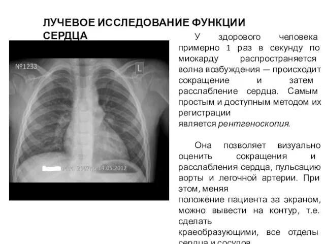 У здорового человека примерно 1 раз в секунду по миокарду