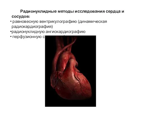 Радионуклидные методы исследования сердца и сосудов: равновесную вентрикулографию (динамическая радиокардиография) радионуклидную ангиокардиографию перфузионную сиинтиграфию.
