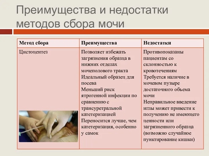 Преимущества и недостатки методов сбора мочи