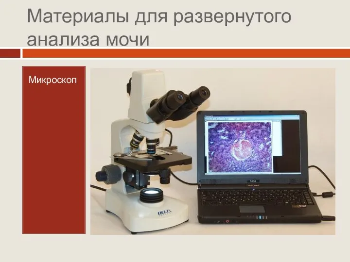 Материалы для развернутого анализа мочи Микроскоп