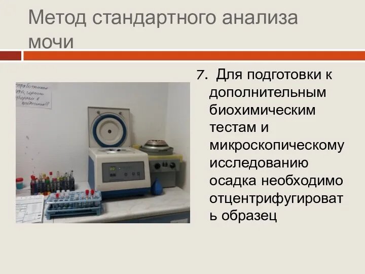 Метод стандартного анализа мочи 7. Для подготовки к дополнительным биохимическим