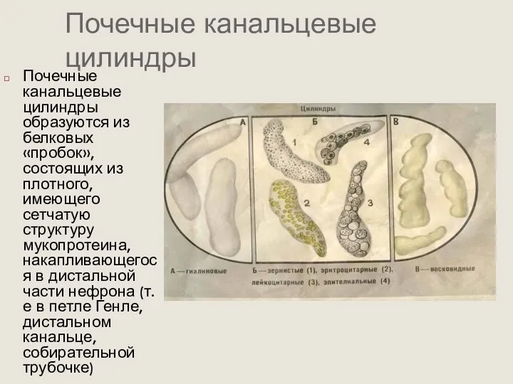 Почечные канальцевые цилиндры Почечные канальцевые цилиндры образуются из белковых «пробок»,