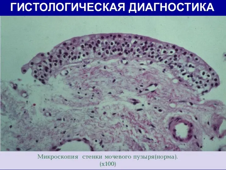 ГИСТОЛОГИЧЕСКАЯ ДИАГНОСТИКА