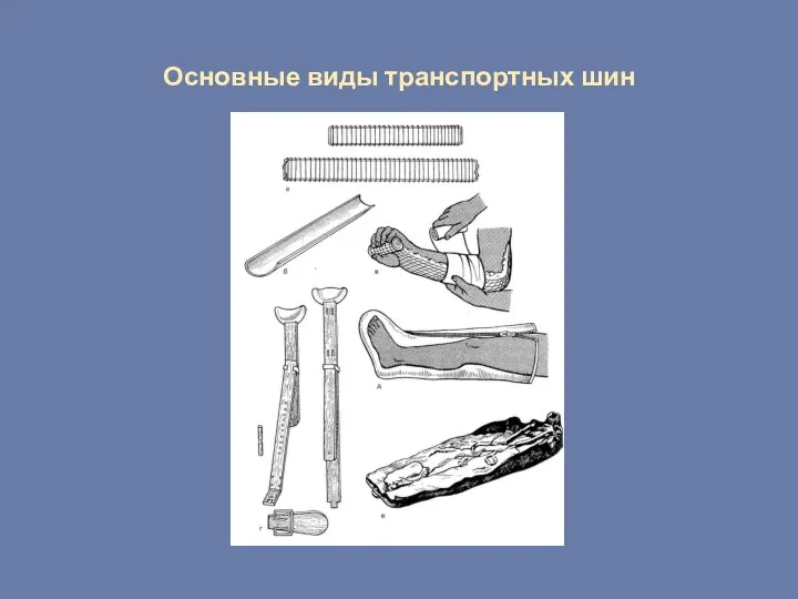 Основные виды транспортных шин