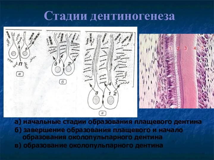 Стадии дентиногенеза а) начальные стадии образования плащевого дентина б) завершение образования плащевого и